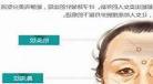 瘊子面相吉凶
